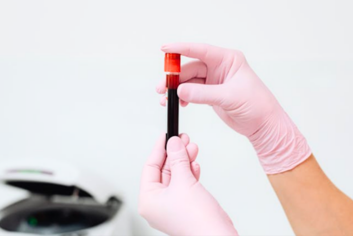 How Much STD Test Cost in the Philippines (1) (1)