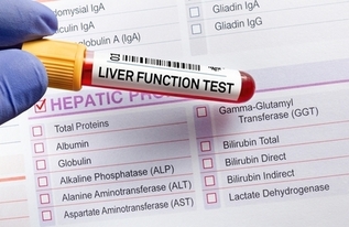 how to tests for liver disease