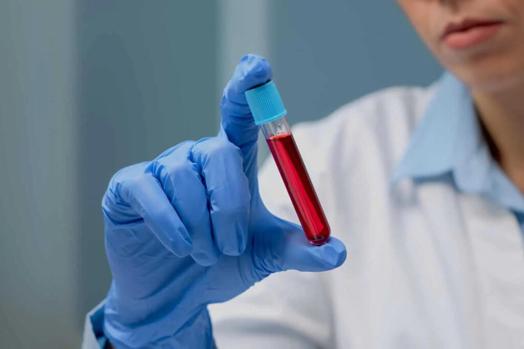  laboratory test for liver