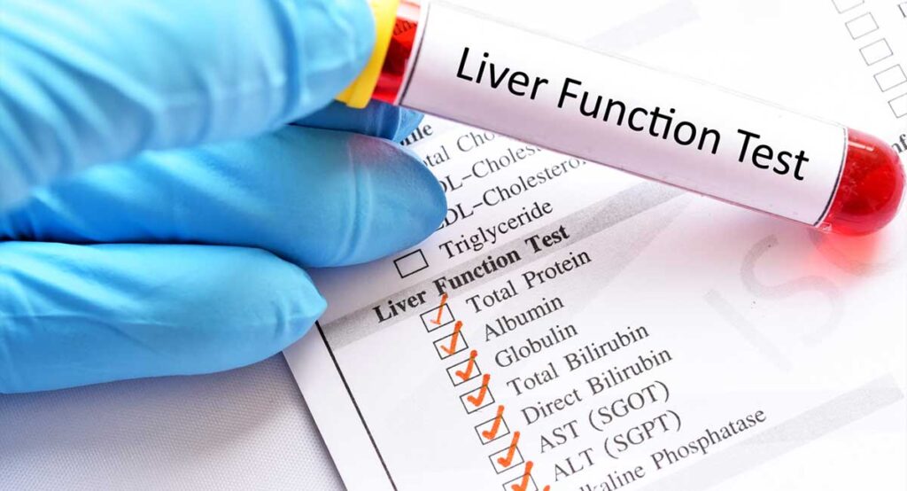 liver function test results