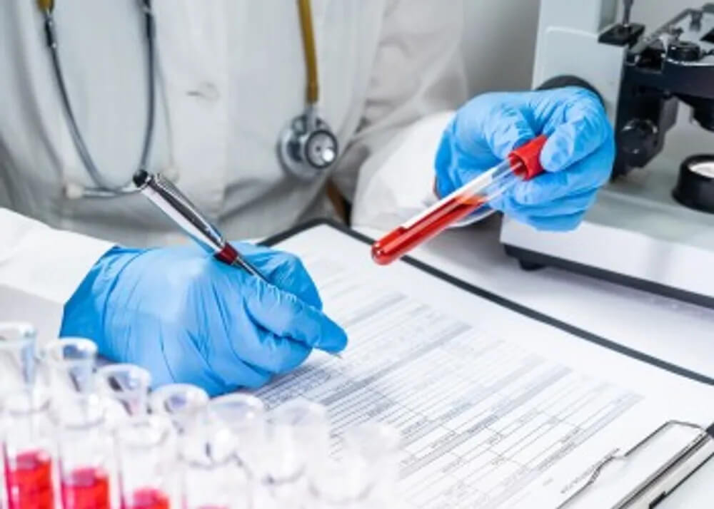 liver function test explained