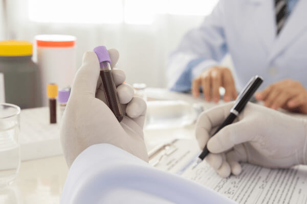 liver function lab test philippines