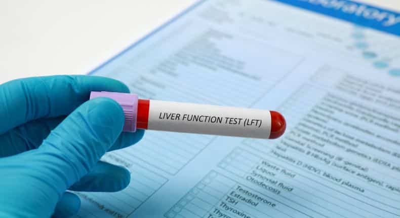 what test for liver problems