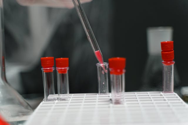 laboratory test help