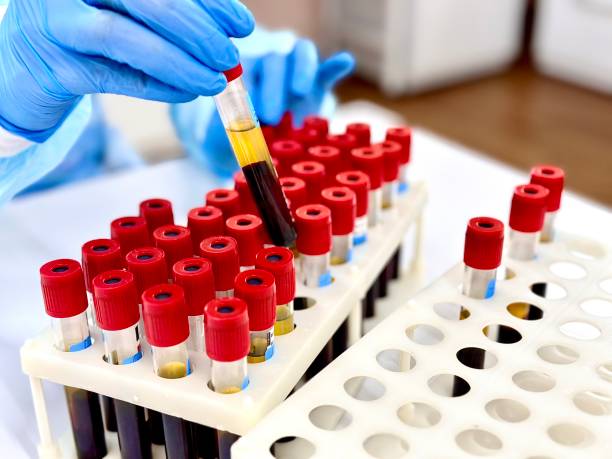Laboratory Testing Guide for Accurate Health Results