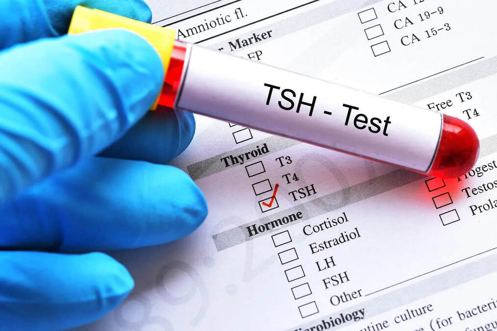 TSH test