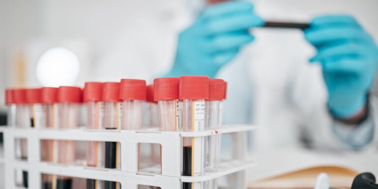 same-day lab test appointment