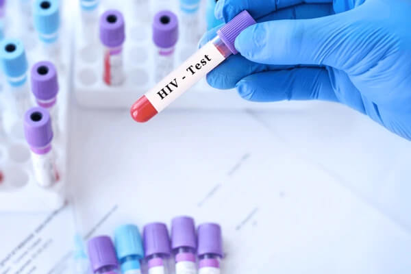 tested for HIV