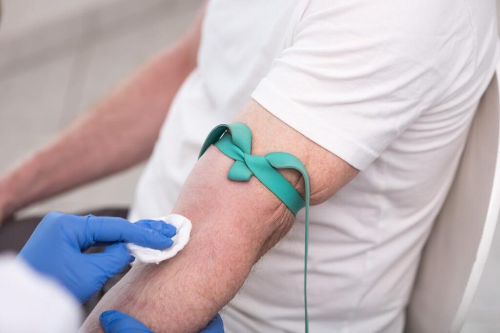 thyroid-stimulating hormone test